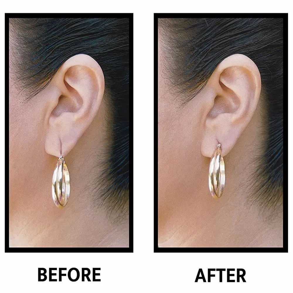 Lobe Wonder Heavy Earring Support Patches -420 Earring Support Patches - 7 Pack